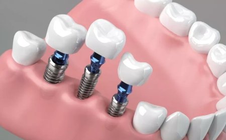 Seniors Can Now Get Affordable Teeth Replaced Service