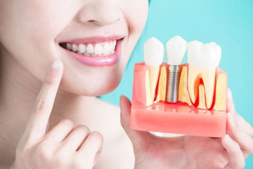 Affordable Dental Implant Services for Seniors 2024