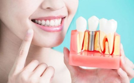 Affordable Dental Implants for Seniors: Navigating Your Options
