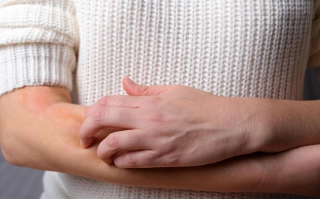 Are you familiar with Plaque Psoriasis Symptoms? Discover More