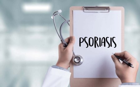 Exploring the Causes of Plaque Psoriasis
