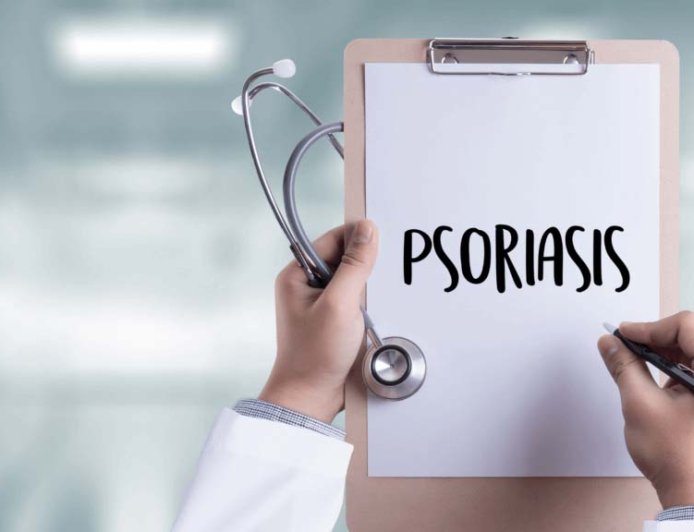 Exploring the Causes of Plaque Psoriasis
