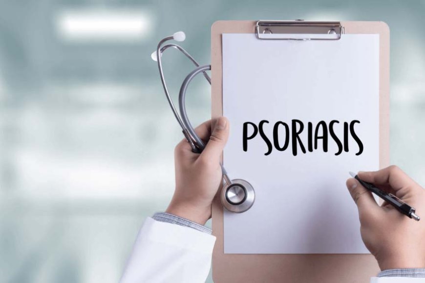 Exploring the Causes of Plaque Psoriasis