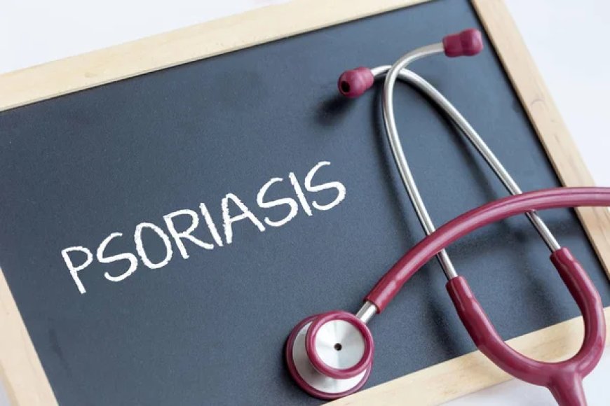 Is It Plaque Psoriasis or Something Else? Recognize the Symptoms