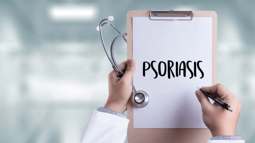 Exploring the Causes of Plaque Psoriasis